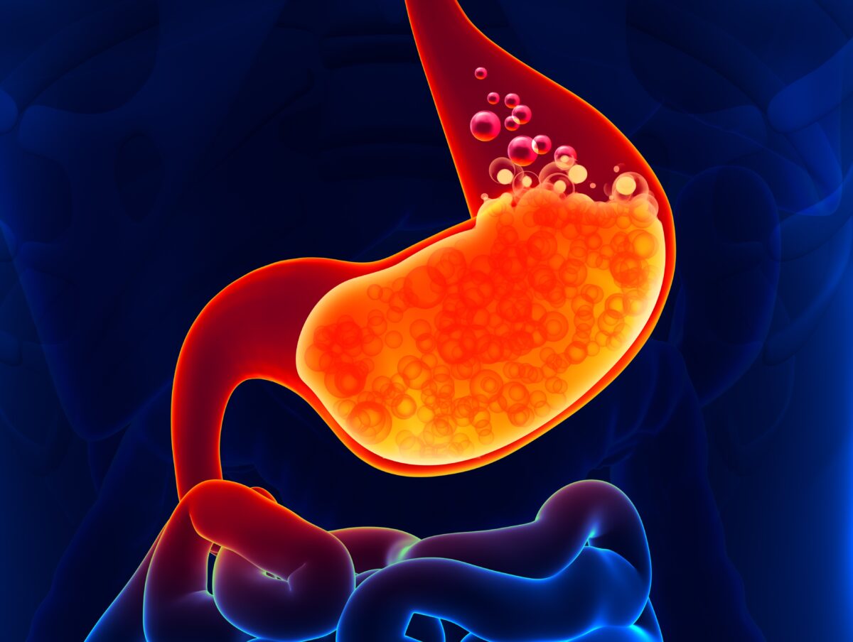 PPIs are common pill for common ailments like heartburn and indigestion. Unfortunately, they also affect a core biological function, affecting your entire body in dangerous ways. (decade3d - anatomy online/Shutterstock)