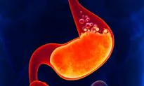 Top 5 Reasons Never to Take a Proton Pump Inhibitor (Acid Blocker)
