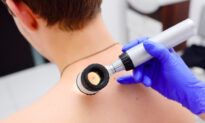 Key Markers Identify Which Melanoma Patients Respond Best to ICI Therapy