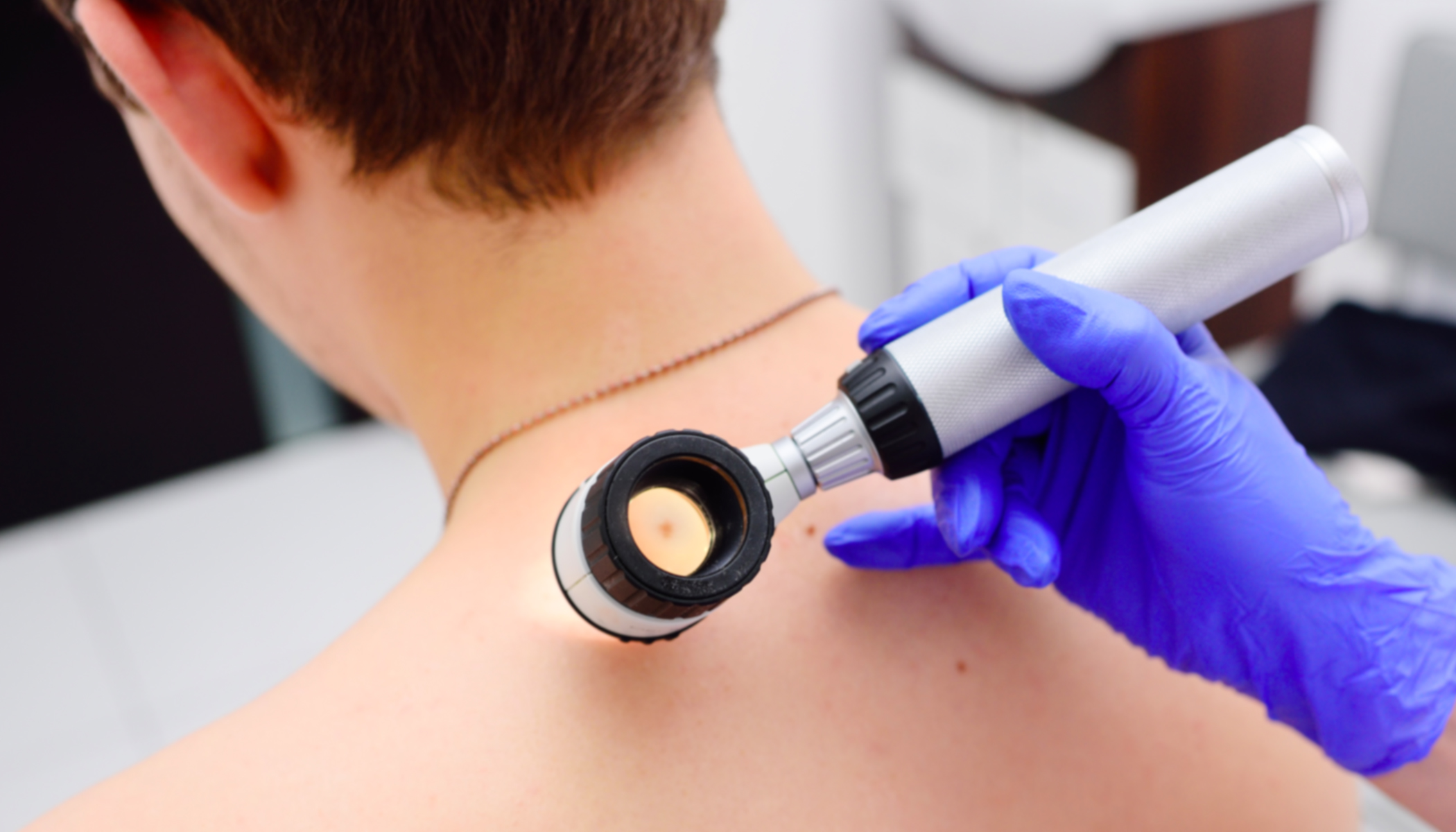 Dad warns sun worshippers after tiny spot on neck turns into giant skin cancer removal