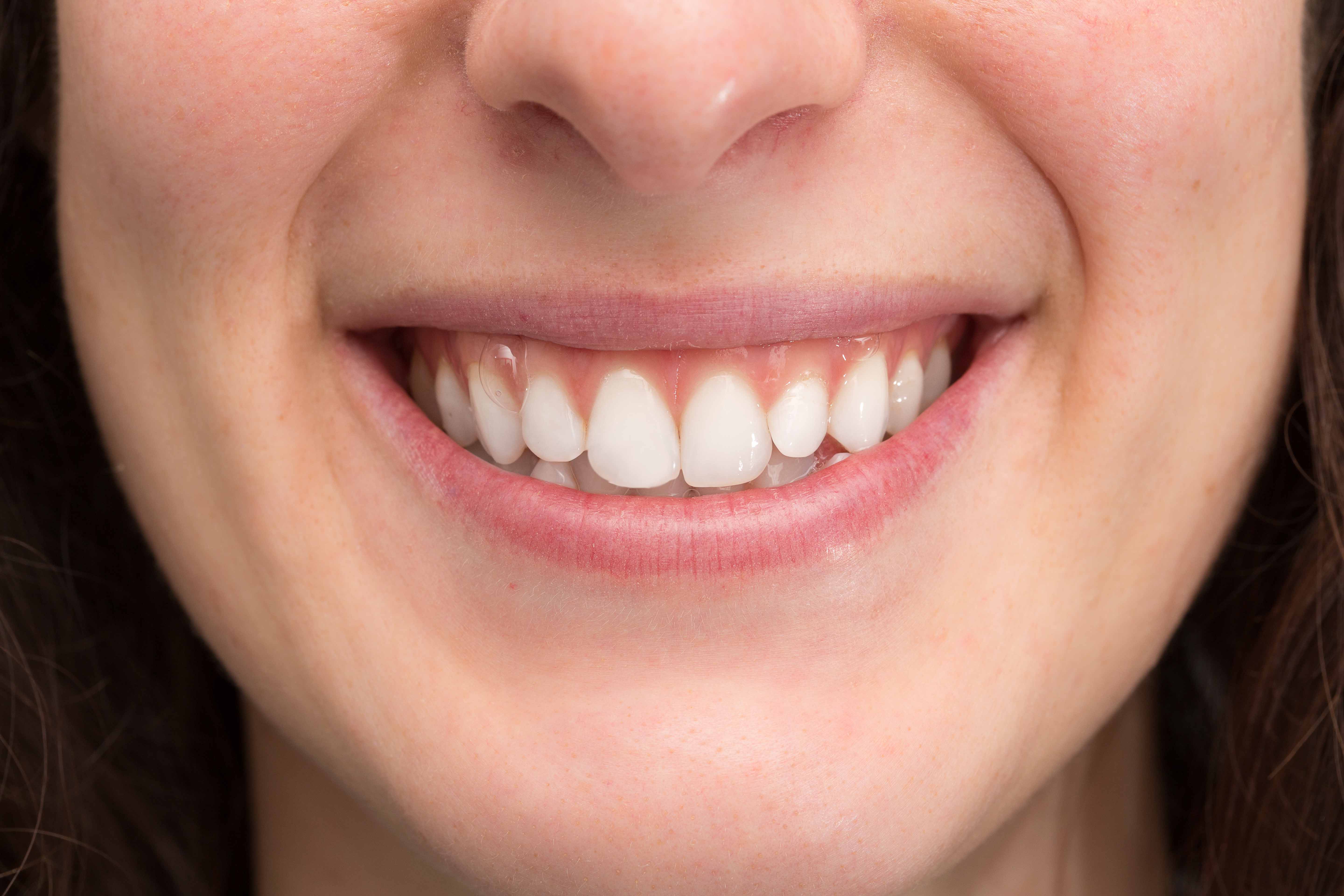 How To Make Different Types Of Teeth With Clay