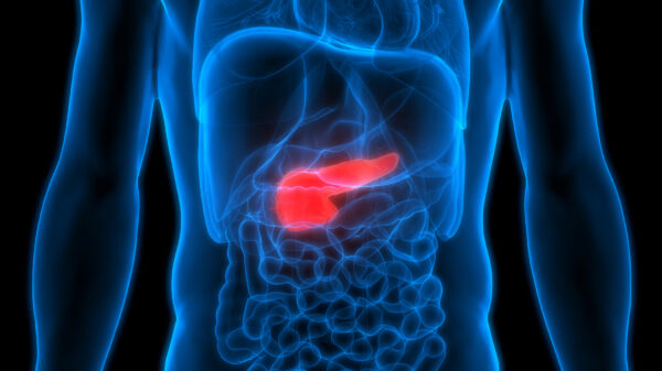 Pancreatic Cancer: Integrating TCM and Western Medicine Can Help