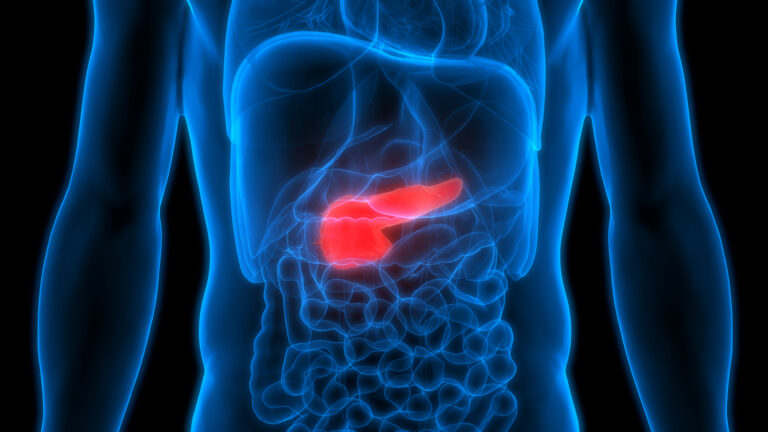9 Signs to Watch for That May Indicate Pancreatic Cancer