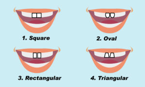 The Shape of Your Two Front Teeth Can Tell About Your Personality–Rectangular Teeth Predict Leadership