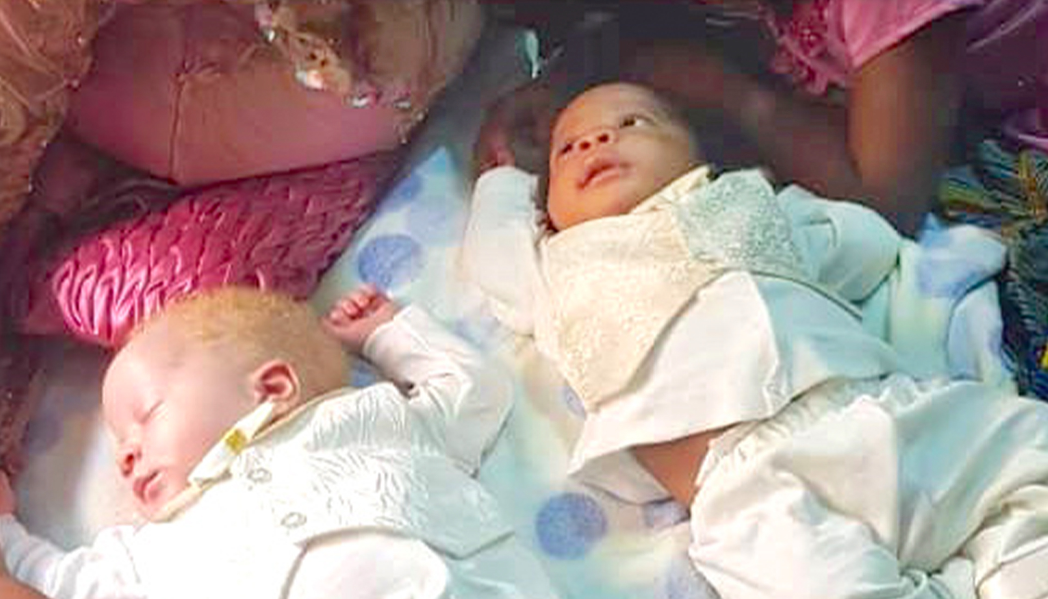 Mom Gives Birth To Rare Twins With Different Skin Colors One Black And One White