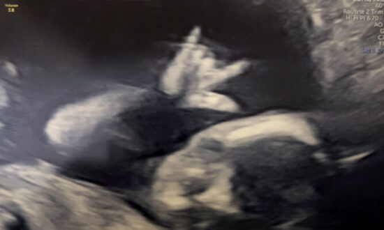 Unborn Baby εκπλήξεις γονείς με ένα βαρύ μεταλλικό ροκ σημάδι κατά την εβδομάδα 19 υπερηχογράφημα