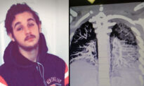 Terrifying Scans Show Teen’s Lungs Clogged ‘Like Hardened Bacon Grease’ From Flavored Vaping