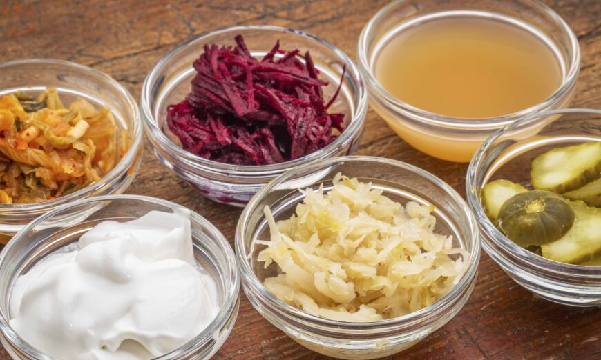 Fermented foods contain beneficial bacteria that take up residence in your gut and help keep you well. (marekuliasz/Shutterstock)