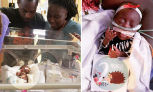 Mom's Ultrasound Scare Leads to Baby Born 15 Weeks Premature Weighing Under 1 Pound