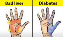 10 Things Your Hands Can Tell About Your Health—Do Your Hands Ever Feel Like Pins and Needles?