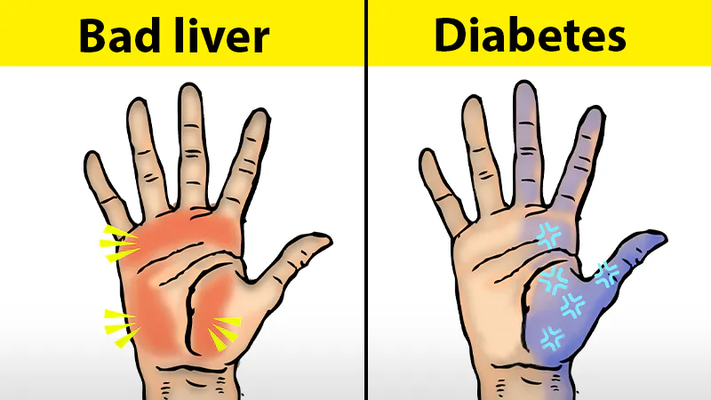 Illustration showing red hands and pins and needles. (Epoch Times)