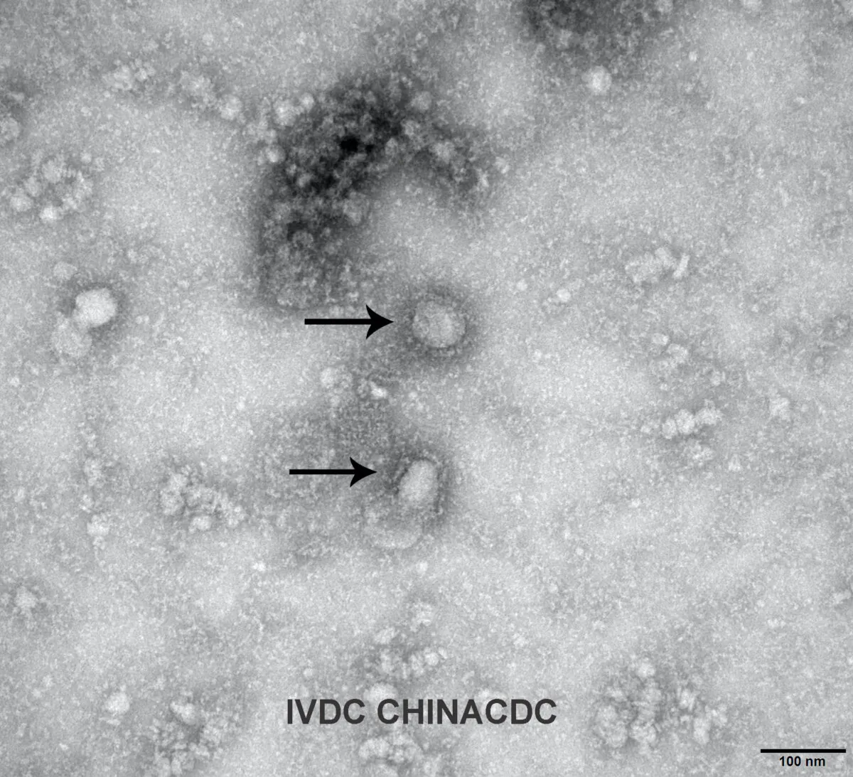 A transmission electron microscopy image of the first isolated case of the coronavirus, on Jan. 27, 2020. (Handout via Reuters)