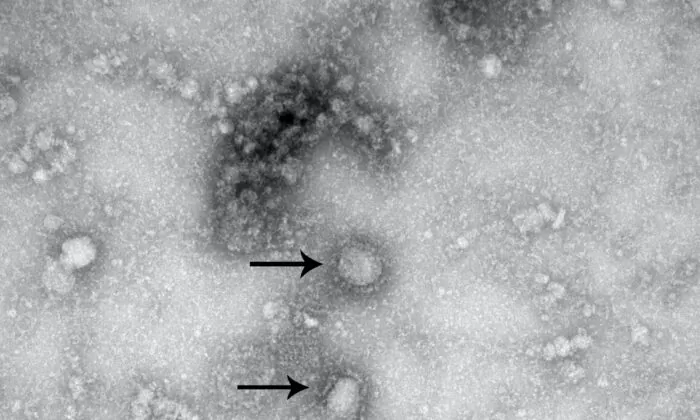 A transmission electron microscopy image of the first isolated case of the coronavirus, on Jan. 27, 2020. (Handout via Reuters)