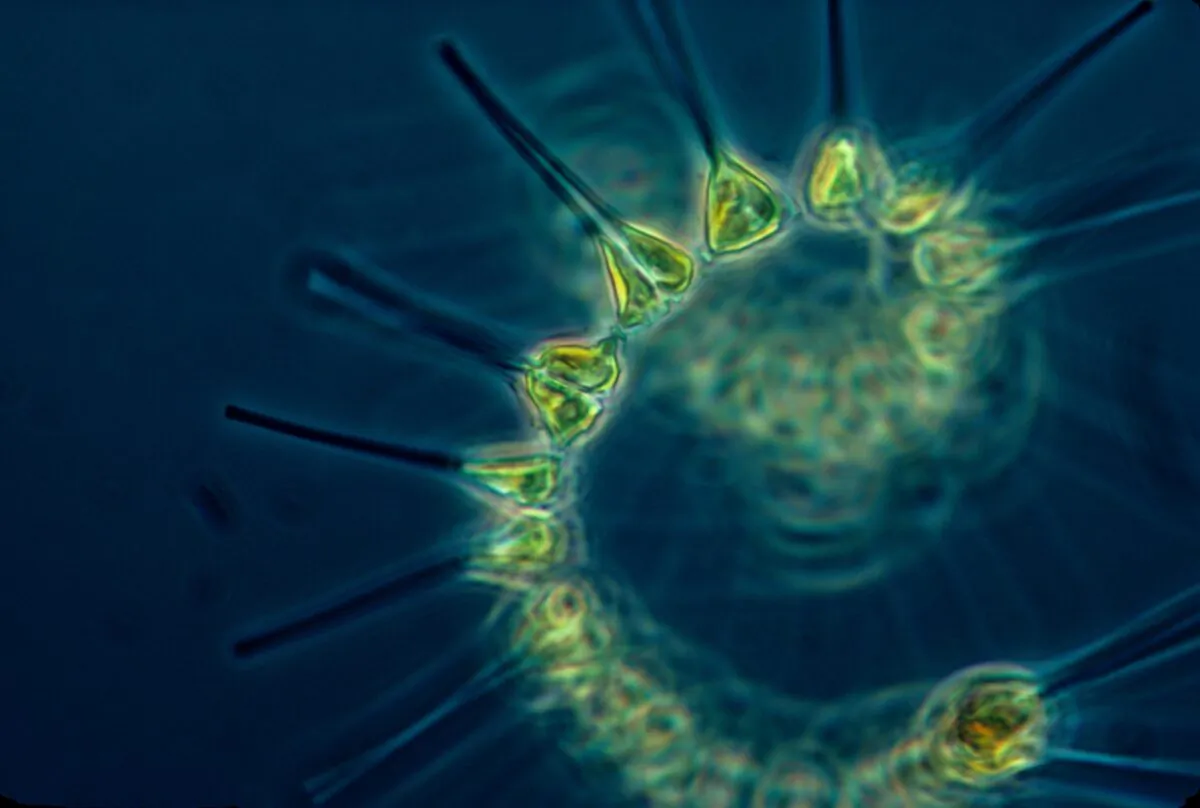File photo of phytoplankton. (NOAA/Unsplash)