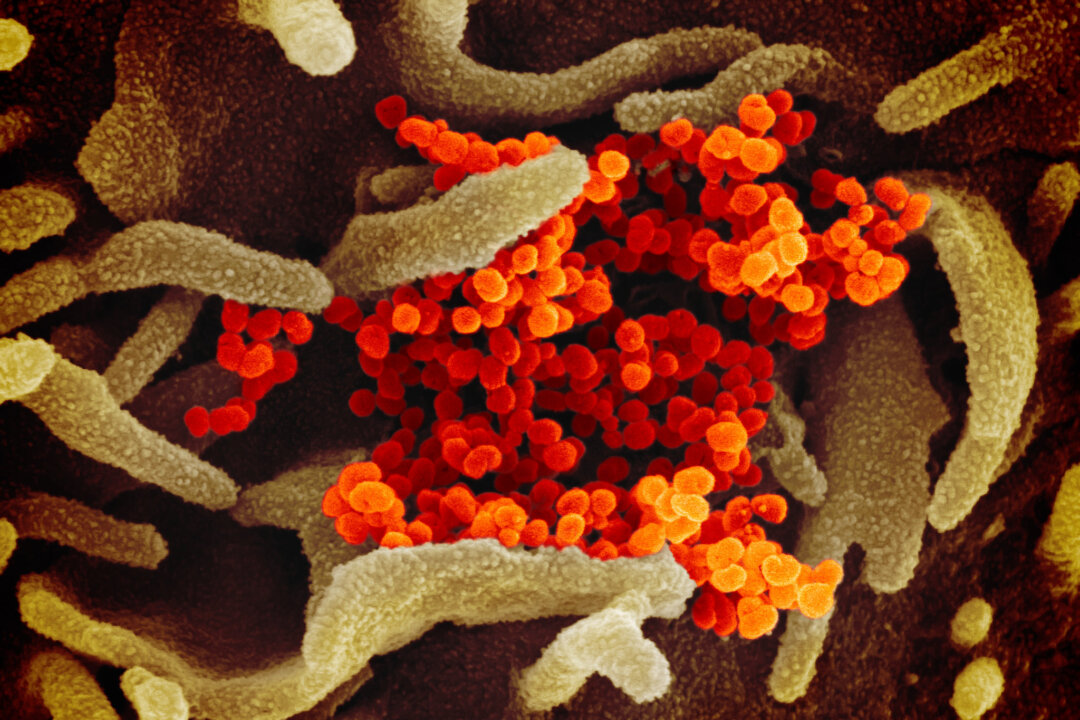 This scanning electron microscope image shows the virus that causes COVID-19. (US National Institutes of Health)