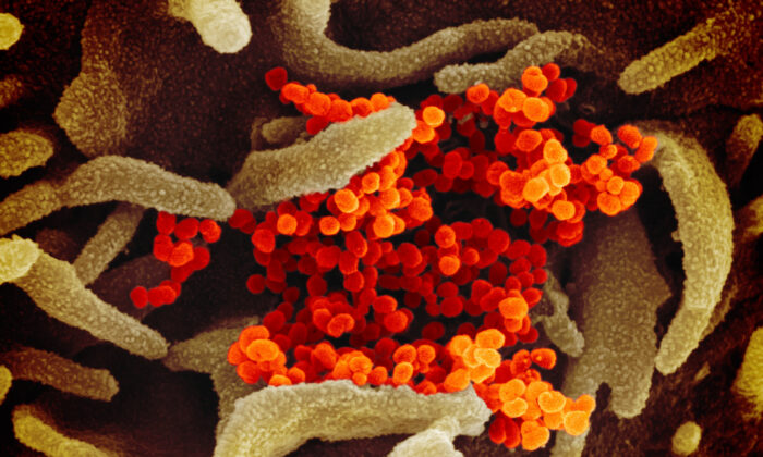 This scanning electron microscope image shows the virus that causes COVID-19 (orange) isolated from a patient in the United States, emerging from the surface of cells (green) cultured in a lab. (NIAID-RML/CC BY 2.0)