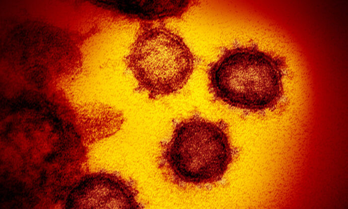 This transmission electron microscope image shows the virus that causes COVID-19 isolated from a patient in the U.S., emerging from the surface of cells cultured in a lab in February 2020. (NIAID-RML/CC BY 2.0)