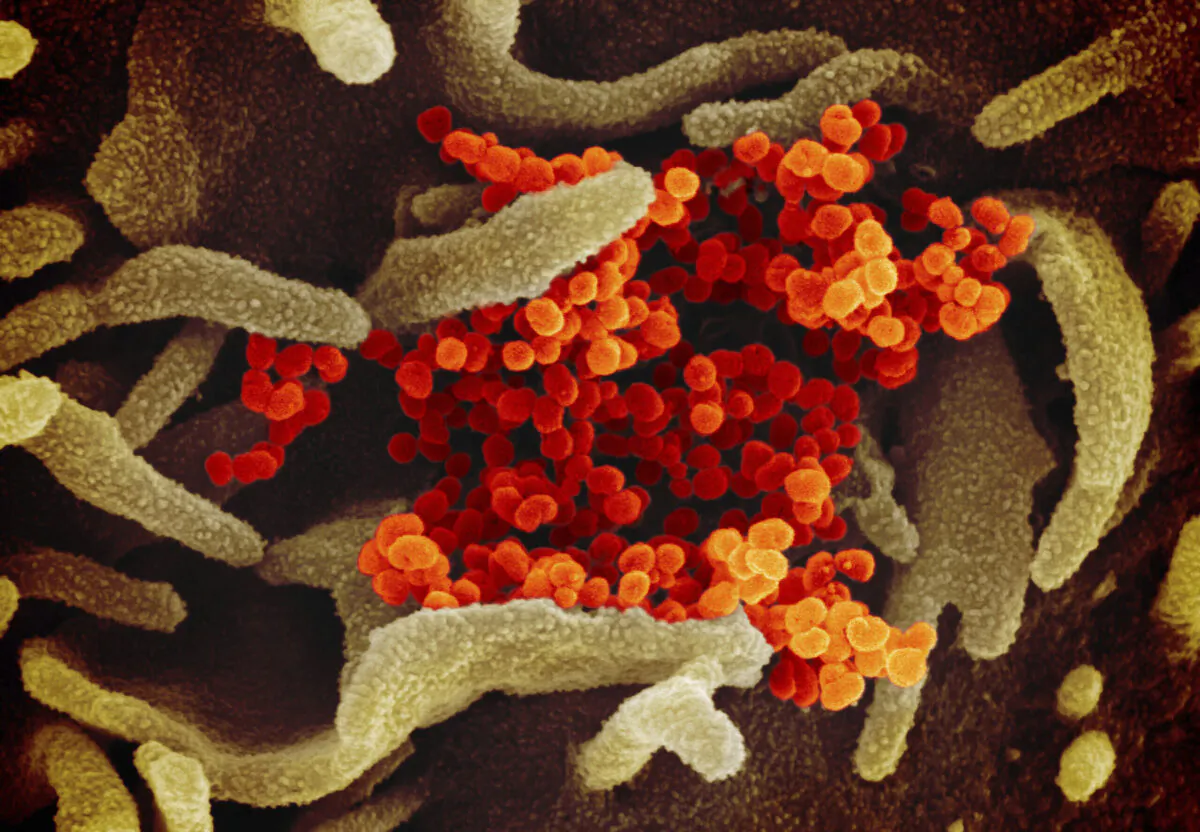 This scanning electron microscope image shows SARS-CoV-2 (orange)—also known as 2019-nCoV, the virus that causes COVID-19—isolated from a patient in the United States, emerging from the surface of cells (green) cultured in the lab. (NIAID-RML via AP)