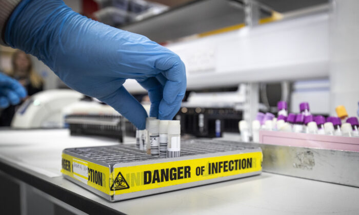 Swab samples in a coronavirus testing laboratory in Scotland in a Feb. 19, 2020. (Jane Barlow - WPA Pool/Getty Images)