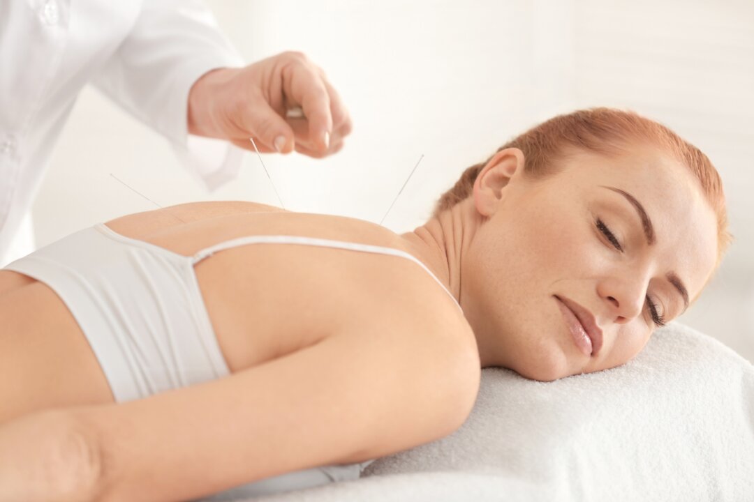 Acupuncture releases endorphins that can have a positive impact on the brain. (Africa Studio/Shutterstock)