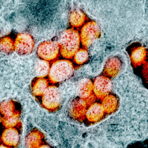 coronavirus