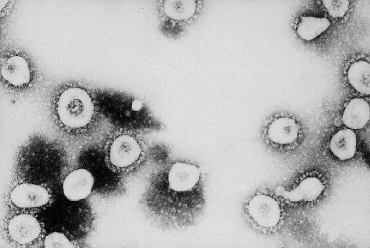 This undated handout photo from the Centers for Disease Control and Prevention (CDC) shows a microscopic view of the novel coronavirus at the CDC in Atlanta, Georgia. According to the CDC the virus that causes Severe Acute Respiratory Syndrome (SARS) might be a "previously unrecognized virus from the Coronavirus family." (CDC/Getty Images)
