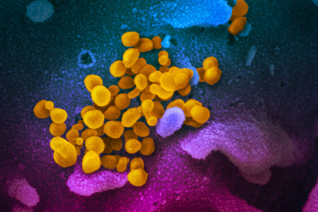 This undated electron microscope image shows SARS-CoV-2, yellow, emerging from the surface of cells, blue/pink, cultured in a laboratory. (Courtesy of NIAID-RML)