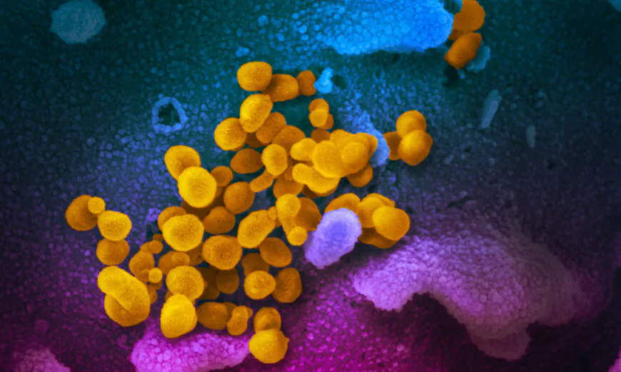 This undated electron microscope image shows SARS-CoV-2, yellow, emerging from the surface of cells, blue/pink, cultured in a laboratory. (Courtesy of NIAID-RML)