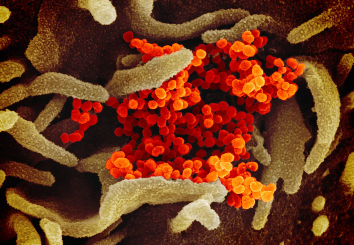 This scanning electron microscope image shows the novel coronavirus (orange), which causes COVID-19 disease, isolated from a patient in the U.S., emerging from the surface of cells (green) cultured in the lab. Photo published on Feb. 13, 2020. (NIAID-RML)