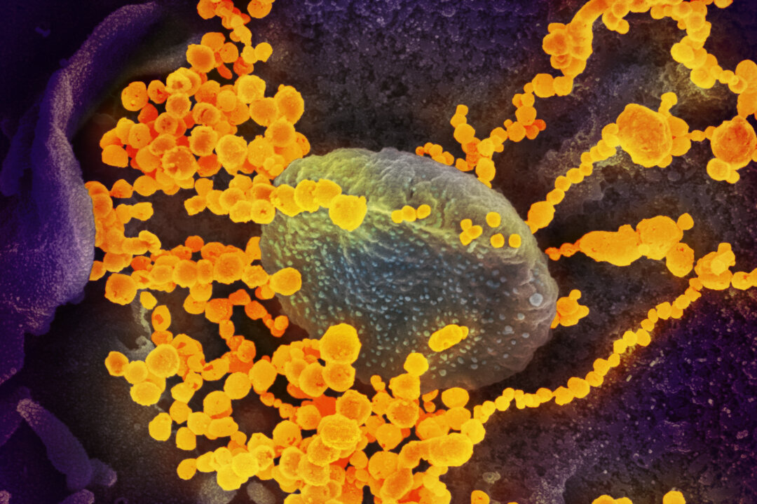 This scanning electron microscope image shows the SARS-CoV-2 virus (round yellowish objects), which The Epoch Times refers to as the CCP virus, emerging from the surface of cells cultured in the lab. Photo published Feb. 19, 2020. (NIAID-RML)