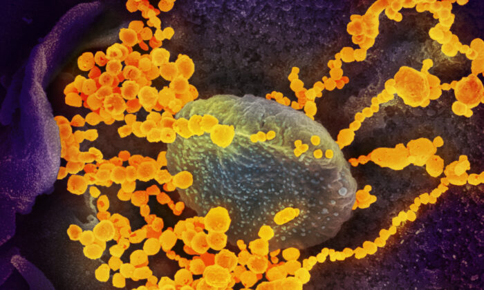 This scanning electron microscope image shows the SARS-CoV-2 virus (round yellowish objects), which The Epoch Times refers to as the CCP virus, emerging from the surface of cells cultured in the lab. Photo published Feb. 19, 2020. (NIAID-RML)