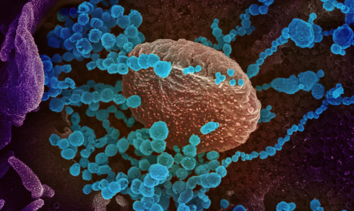 Scanning electron microscope image shows the CCP virus (round blue objects), the virus that causes COVID-19, emerging from the surface of cells cultured in the lab. (NIAID-RML)