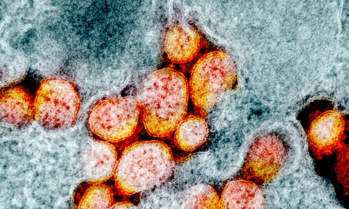 Transmission electron micrograph of CCP virus particles, isolated from a patient. Image captured and color-enhanced at the NIAID Integrated Research Facility (IRF) in Fort Detrick, Md. (NIAID)

