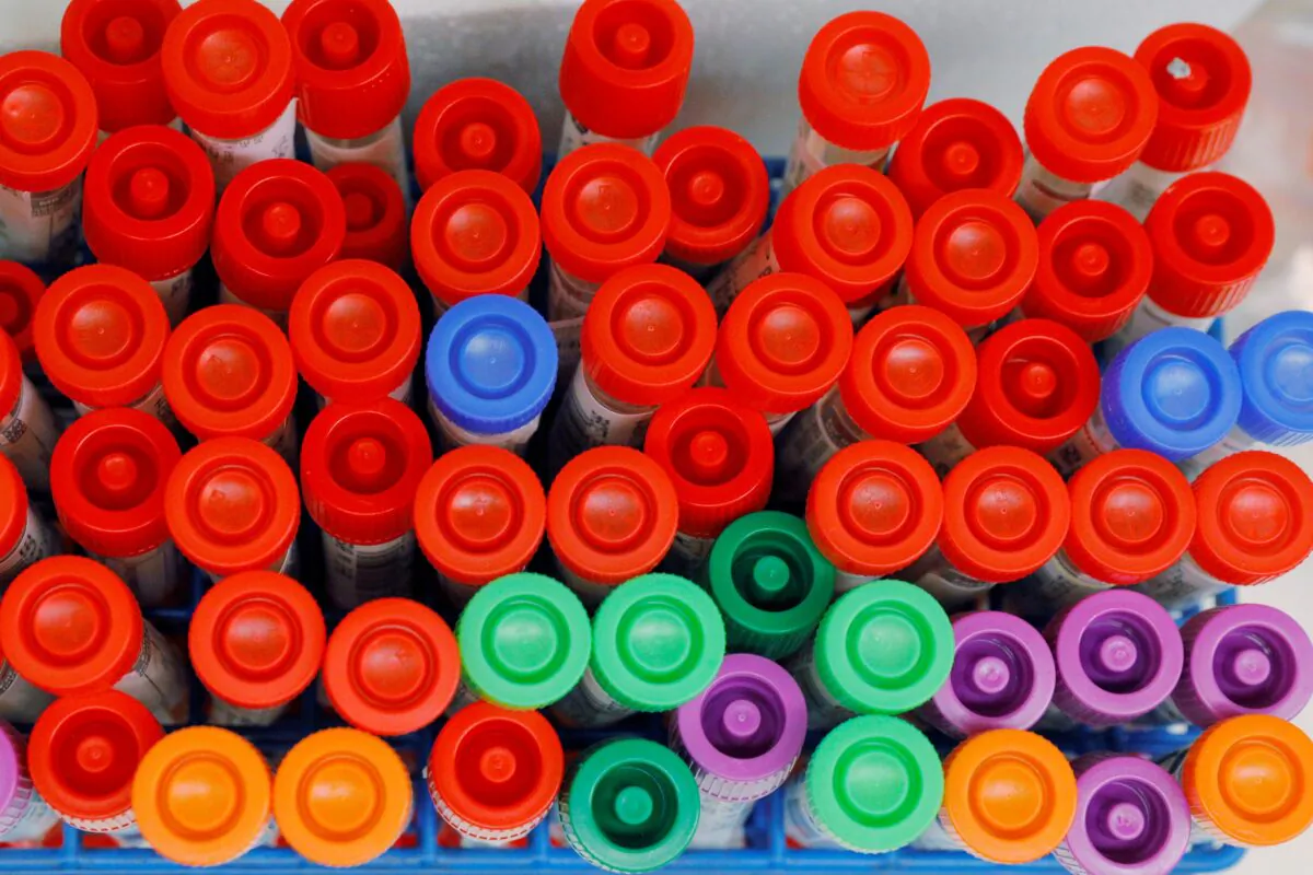 Specimens from CCP virus tests are logged to be processed for a positive or negative result at the UW Medicine Virology lab in Seattle on March 18, 2020. (Brian Snyder/Reuters)