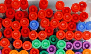 FDA Approves First Antibody Test for COVID-19