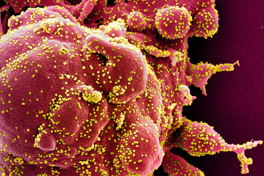 Colorized scanning electron micrograph of an apoptotic cell (red) heavily infected with CCP virus particles (yellow), isolated from a patient sample. Image captured at the NIAID Integrated Research Facility (IRF) in Fort Detrick, Md., published on April 2, 2020. (NIAID)