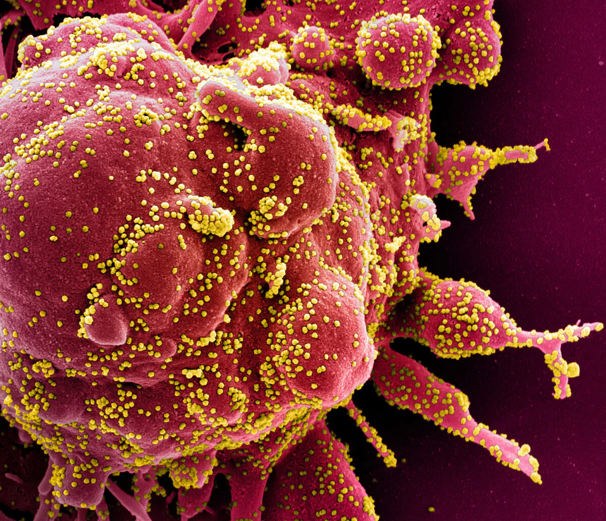 Colorized scanning electron micrograph of an apoptotic cell (red) heavily infected with CCP virus particles (yellow), isolated from a patient sample. Image captured at the NIAID Integrated Research Facility (IRF) in Fort Detrick, Md., published on April 2, 2020. (NIAID)