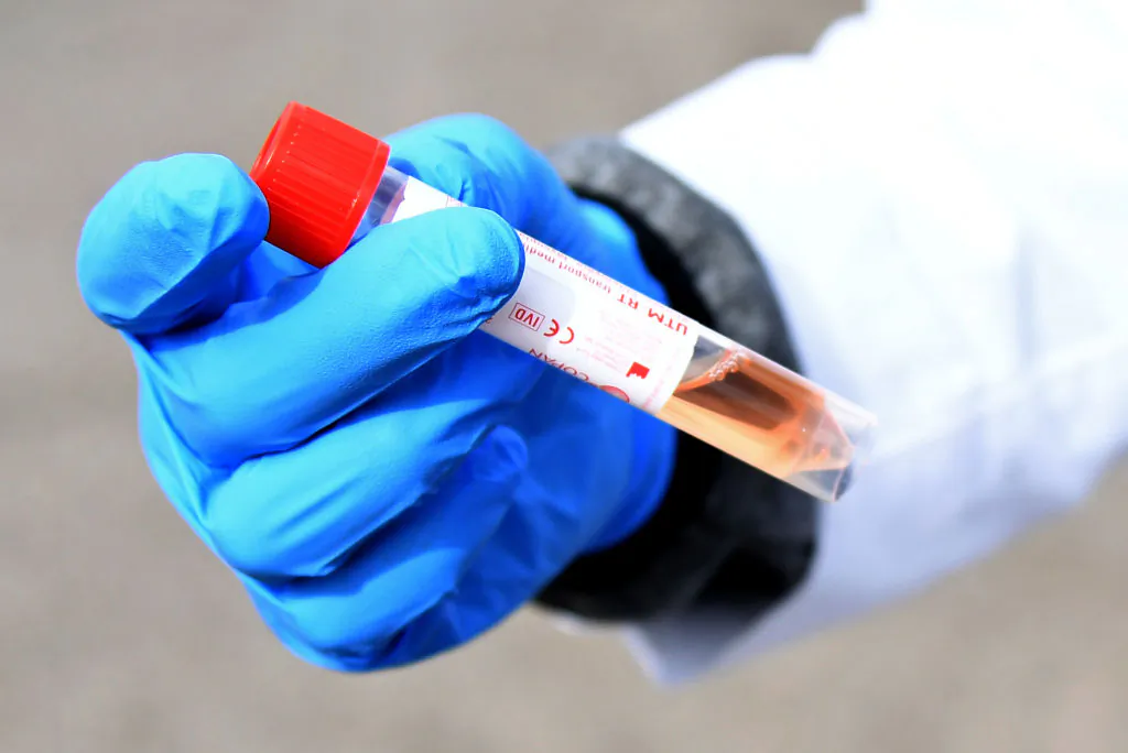 A file photo of a COVID-19 test vial at a drive-up testing station at the University of Nevada, Las Vegas, on April 6, 2020. (Ethan Miller/Getty Images)