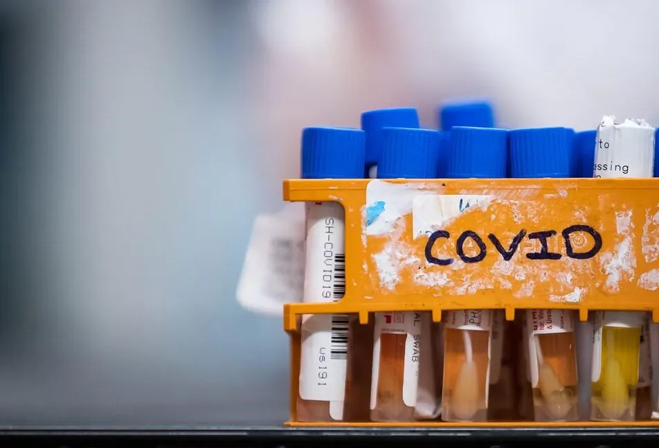 Specimens to be tested for COVID-19 are seen at LifeLabs after being logged upon receipt at the company's lab, in Surrey, B.C., on March 26, 2020. (Darryl Dyck/The Canadian Press)