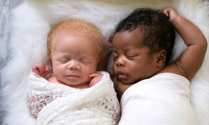 To baby birth couple gives nigerian white White Baby