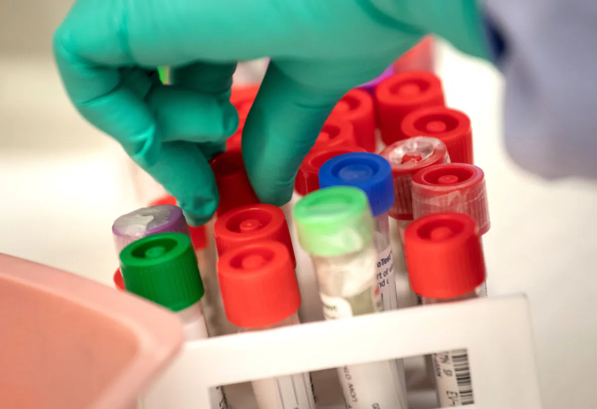 A medical Laboratory scientist tests vials of samples for CCP virus at the University of Washington Medicine virology lab in Seattle, on March 13, 2020. (John Moore/Getty Images)