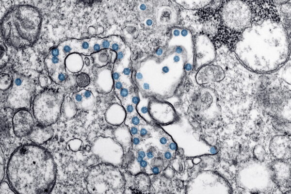 particles-of-the-coronaviru