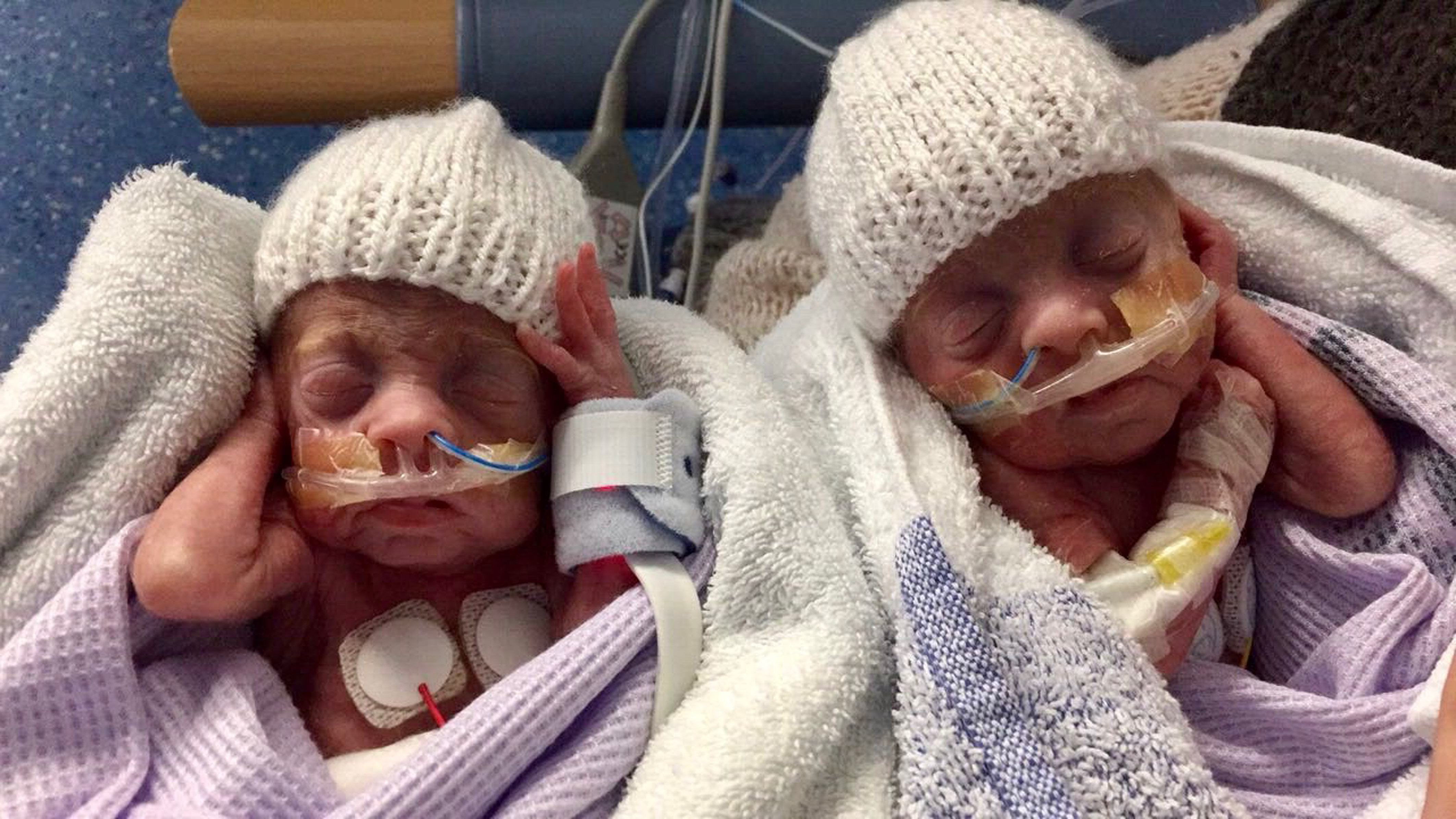 miracle-twins-born-at-24-weeks-beat-the-odds-to-survive-and-are-now