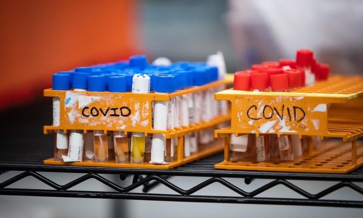Specimens to be tested for COVID-19 are seen at LifeLabs after being logged upon receipt at the company’s lab, in Surrey, B.C., on March 26, 2020. (Darryl Dyck/Canadian Press)