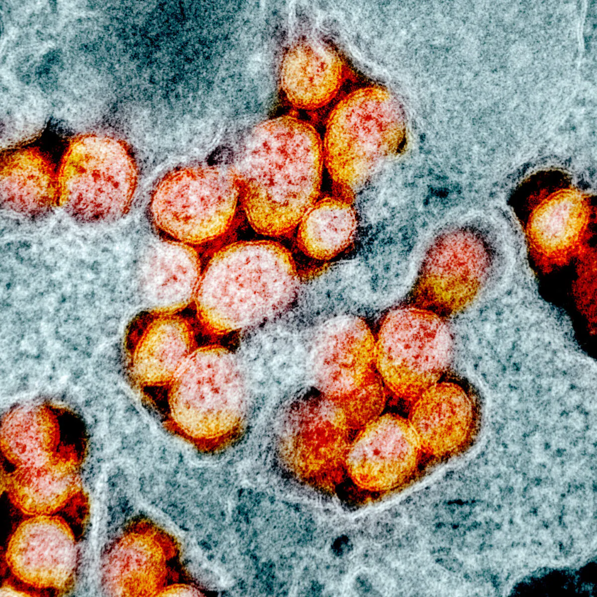 Transmission electron micrograph of SARS-CoV-2, or CCP virus particles, isolated from a patient. Image captured and color-enhanced at the NIAID Integrated Research Facility (IRF) in Fort Detrick, Maryland. (NIAID)