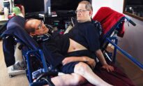 World’s Longest-Surviving Conjoined Twin Brothers Die at 68