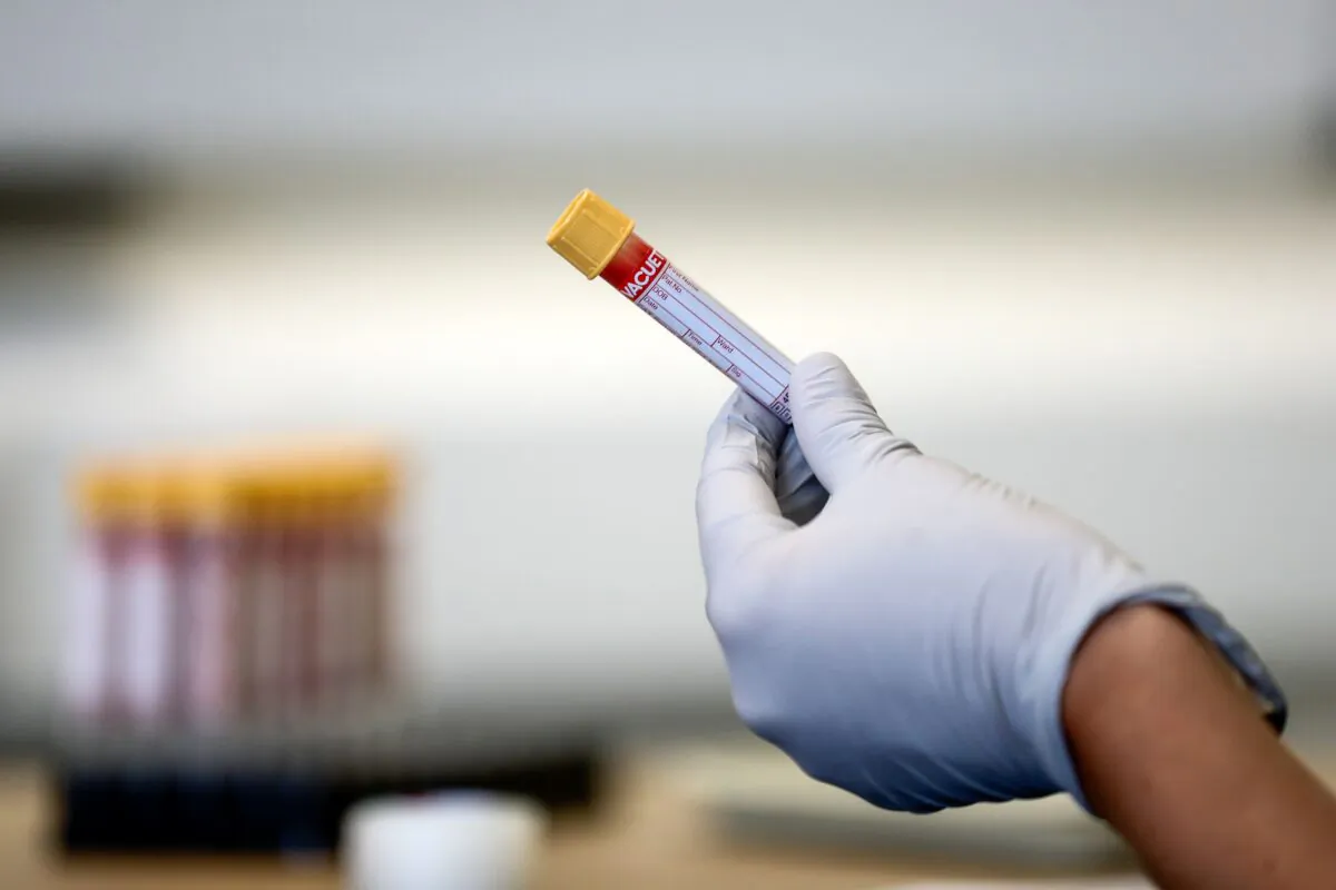 A paramedic holds a test tube containing a blood sample during an antibody testing programme in Birmingham, Britain, on June 5, 2020. (Simon Dawson/POOL/AFP/Getty Images)