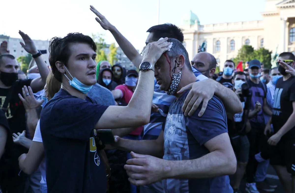 Actor and leader of PSG movement Sergej Trifunovic receives help after being attacked by protesters during an anti-government rally, amid the spread of the  disease (COVID-19), in front of the parliament building in Belgrade, Serbia, on July 8, 2020. (Marko Djurica/Reuters)