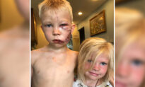 6-Year-Old Boy Mauled by Dog While Protecting Sister: ‘If Someone Had to Die, It Should Be Me’