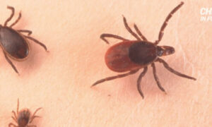 China in Focus (Aug. 5): Another Infectious Virus Spreads, Kills 7